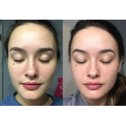 كريم حمض الازيلك من ذا اورديناري كريم حمض الازيلك من ذا اورديناري