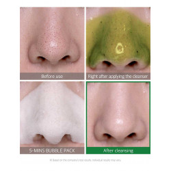 غسول المعجزه وداعا للرؤوس السوداء من سوم باي مي غسول المعجزه وداعا للرؤوس السوداء من سوم باي مي