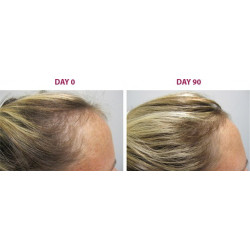 سيروم ملتي بيبتيد للشعر من ذا اورديناري سيروم ملتي بيبتيد للشعر من ذا اورديناري