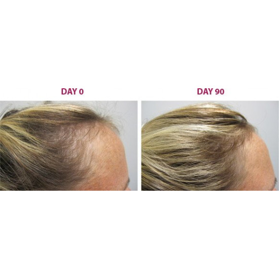 سيروم ملتي بيبتيد للشعر من ذا اورديناري