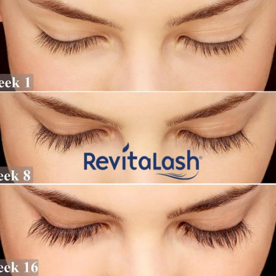 مرطب الرموش ريفيتالاش أدفانسد-٢ مل مرطب الرموش ريفيتالاش أدفانسد-٢ مل