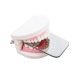 5pcs/set Dental Double Side Orthodontic Reflector Intra-oral Photography Mirrors Reflector for Orthodontic Taking Photo