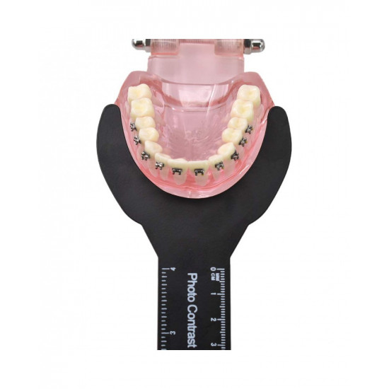 6Pcs Dental Photo Contrast Black Background Board Mirror Photography Contraster