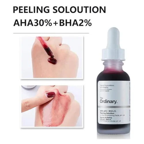محلول التقشير الأحمر والأكثر شهرة بالتوليفة السريرية الفائقة (AHA 30% + BHA 2%)  من ذا أورديناري The Ordinary لتجديد خلايا البشرة ومكافحة العيوب – 30 مل