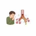 البلغم والكحة المستمرة