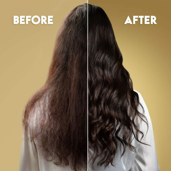 هيد اند شولدرز بلسم تجديد 200 مل