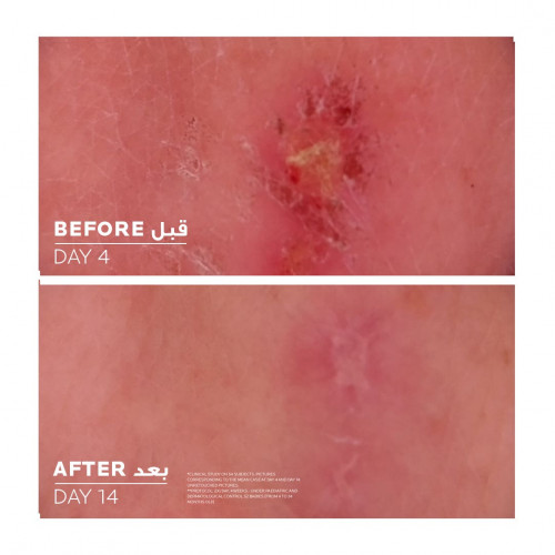 لاروش بوزيه سيكابلاست بوم بي 5+ كريم ملطف ومعالج 40 مل