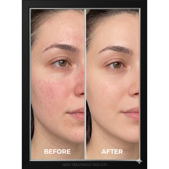 THE CELL LAB CellTone Toner 150 ml