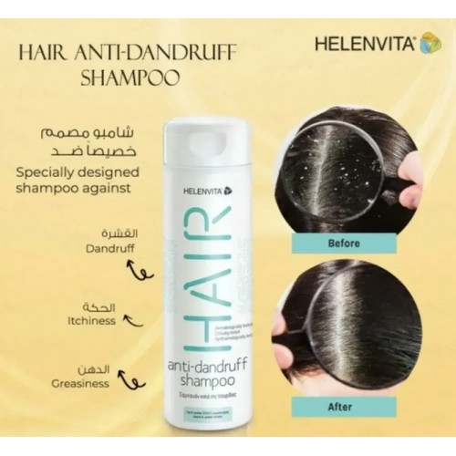 هيلين فيتا للشعر ضد القشرة 300 مل