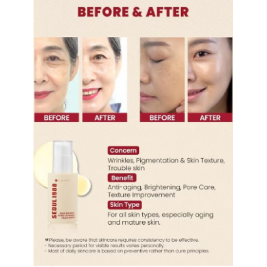 Seoul 1988 Serum: Liposome Reticulin 2% + Black Ginseng 30ml