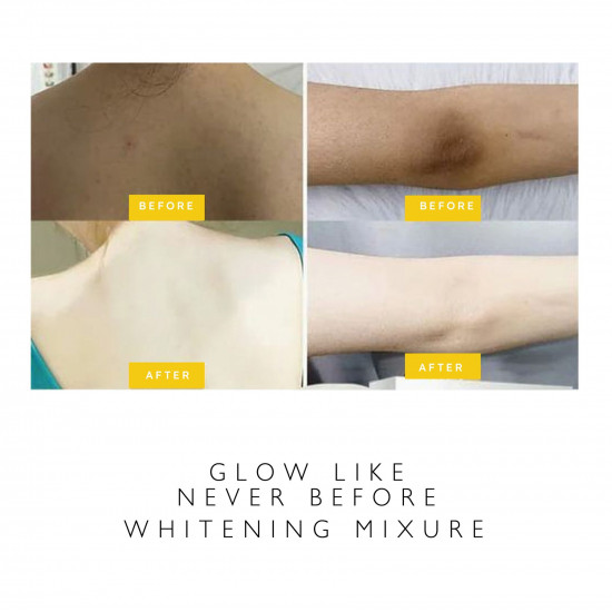 الهيدروبلابر 100 مل الهيدروبلابر 100 مل