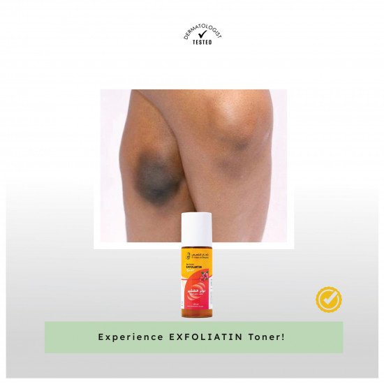 تونر التقشير تونر التقشير