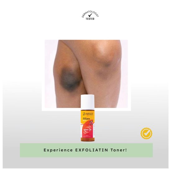 Exfoliating toner