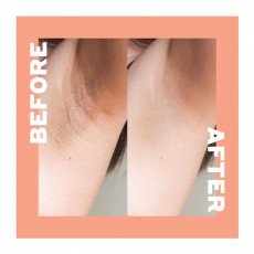 كريم تقشير المناطق الحساسة