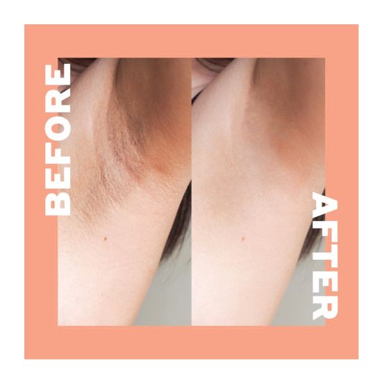 Exfoliating sensitive areas