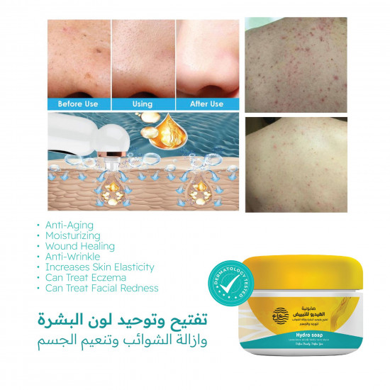 صابونية الهيدرو صابونية الهيدرو