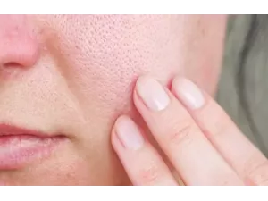 7 خطوات فعّالة لتقليص المسام الواسعة