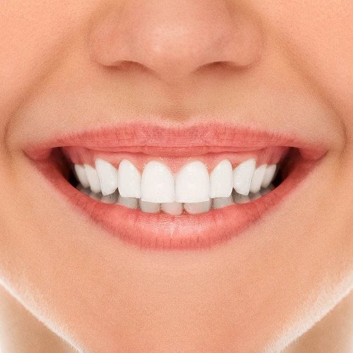 فيتى دينت كريم لطقم الاسنان 40 جم