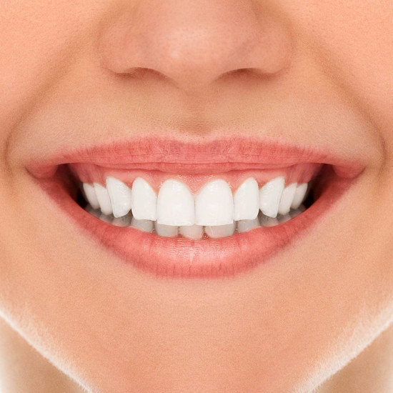 فيتى دينت كريم لطقم الاسنان 40 جم