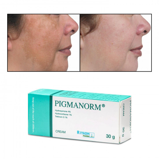 لويس - وايدمر كريم بيجمانورم 30 مل