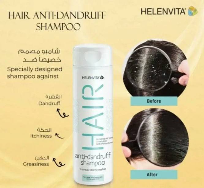هيلين فيتا للشعر ضد القشرة 300 مل