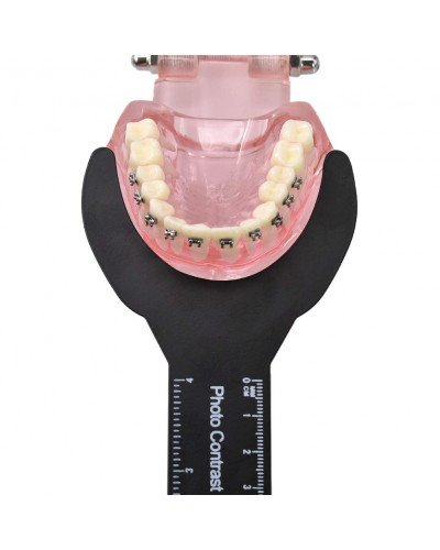 6pcs Dental Orthodontic Black Background Photo Image Contrast Board Oral Cheek Plate with Scale Mark Autoclavable Dentist Tools