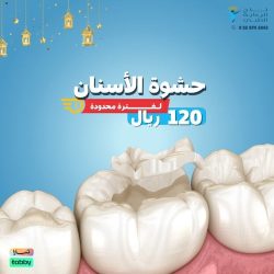 حشوة الاسنان