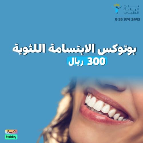 بوتوكس الابتسامة اللثوية