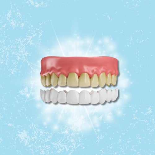 تبيض الأسنان المنزلي تبيض الأسنان المنزلي