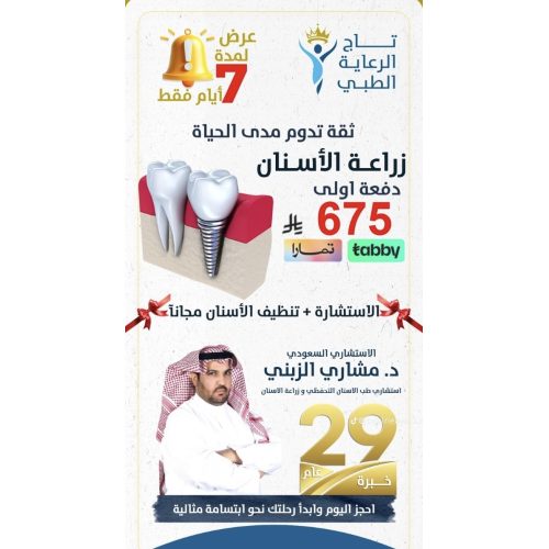 dental implant 4 ora implants