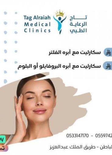 سكارليت مع ابرة الفلتر سكارليت مع ابرة الفلتر