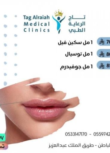 1 مل فيلر جوفيدريم 1 مل فيلر جوفيدريم