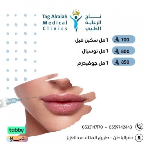 1 مل توسيال