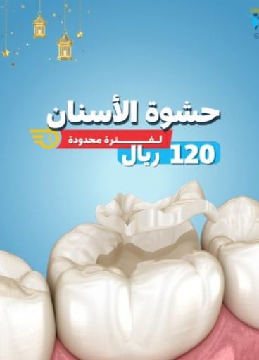 حشوة الاسنان حشوة الاسنان