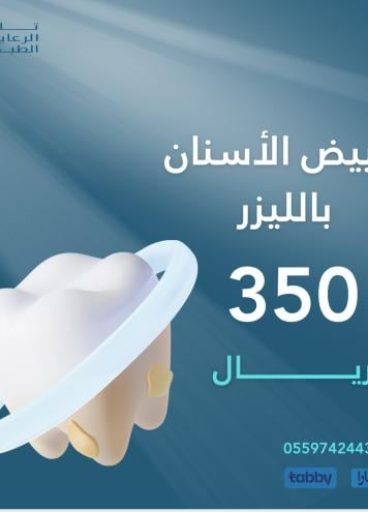 تبيض الأسنان بالليزر